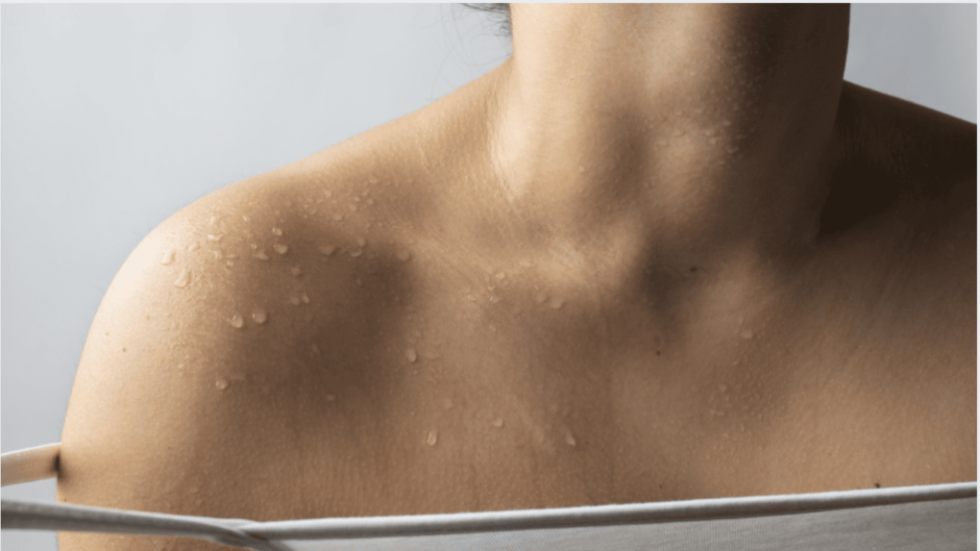 Schwitzen, Brustgeruch, Intertrigo, Frauenpflege, Hautfalten