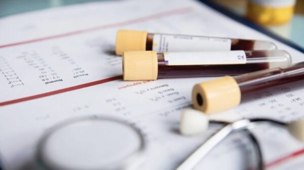 Hausarzt‑Insights: Was Ihr Blut über Gesundheit, Leber, Schilddrüse & Herz verrät – inkl. Tipps, Mythen‑Check und Terminlink zur Blutuntersuchung in München