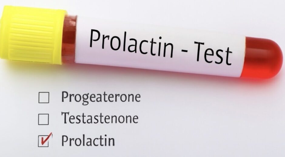 Wie erkennt man einen zu hohen Prolaktinspiegel? Was sind typische Symptome – und welche Behandlungen helfen bei Hyperprolaktinämie?