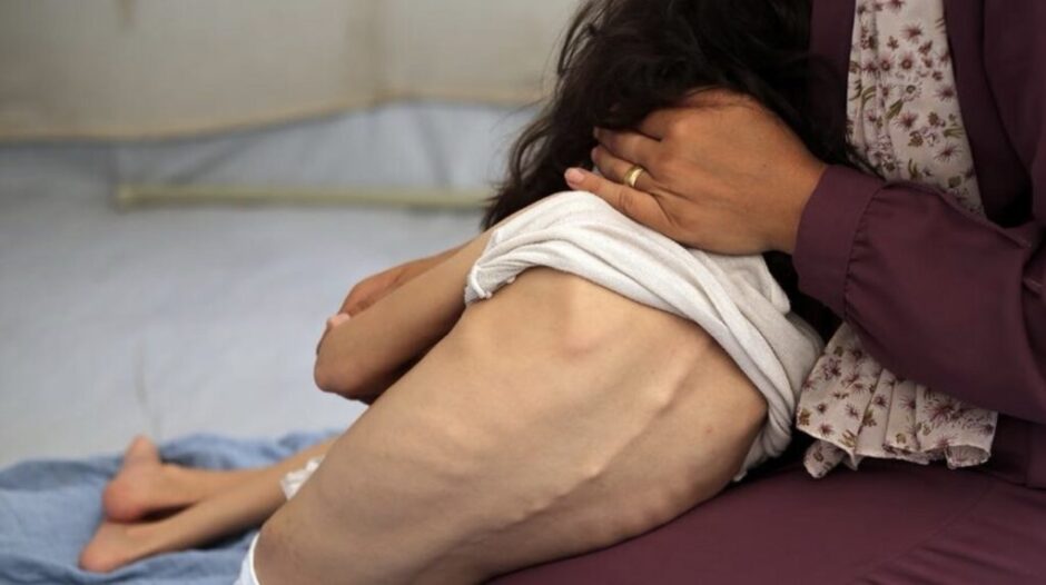 UNO bestätigt erstmals Hunger in Gaza: Über 500.000 Menschen betroffen, mehr als 250 Todesopfer. Israel weist Vorwürfe zurück, Hilfswerke warnen.