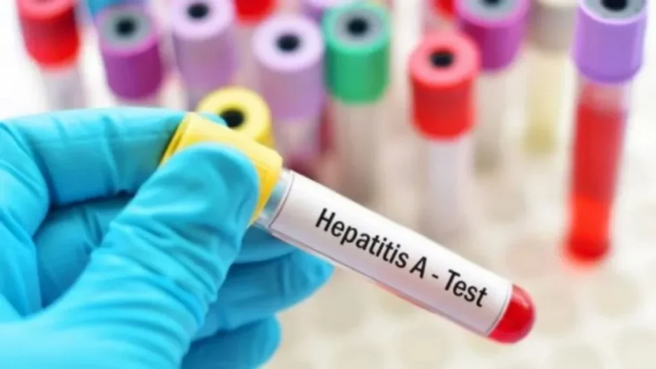 Hepatitis-A-Ausbruch im Prešovský kraj (Slowakei) sorgt für Besorgnis. Was Reisende und Deutsche jetzt wissen sollten – Tests, Schutz, Ausbreitung.